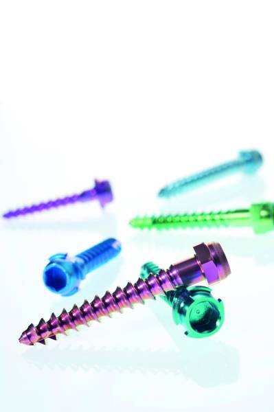 Anodisation du titane médical : un traitement de surface pour une coloration durable et une résistance a la corrosion